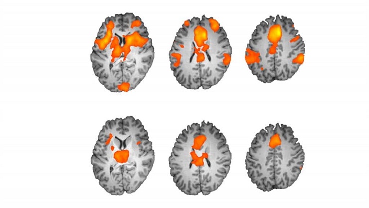 napping brain scans