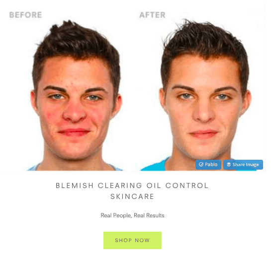juice beauty's Before-and-After Pictures