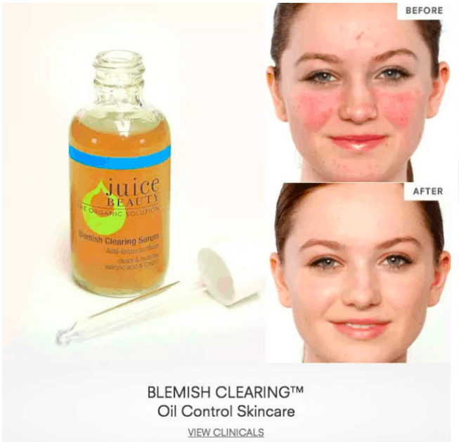 juice beauty's Before-and-After Pictures